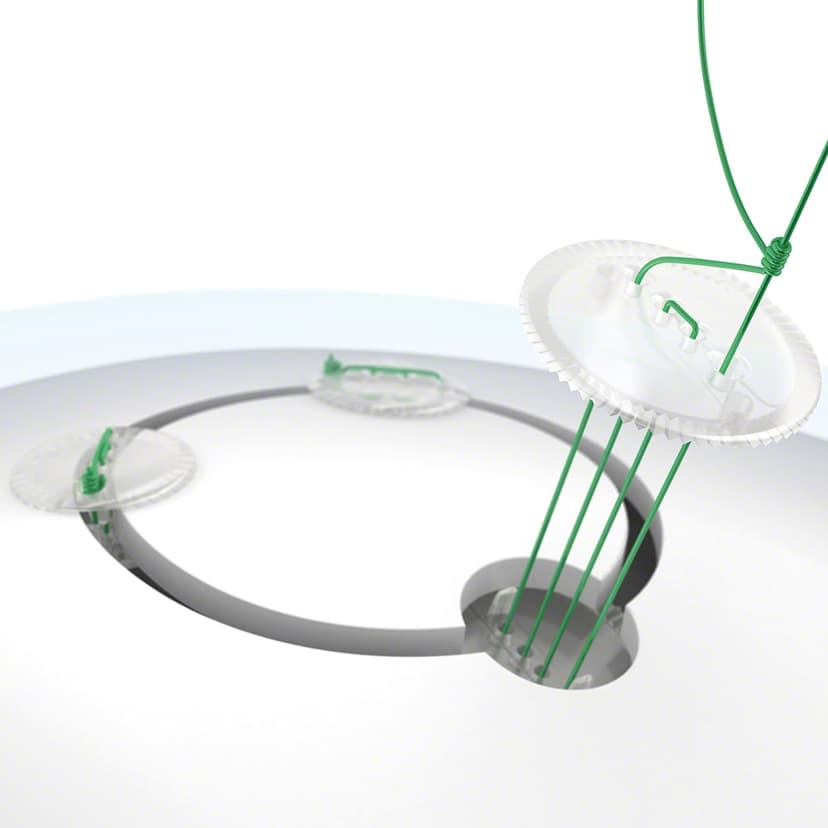 CranioFix® absorbable-Product Picture Enlargement CW